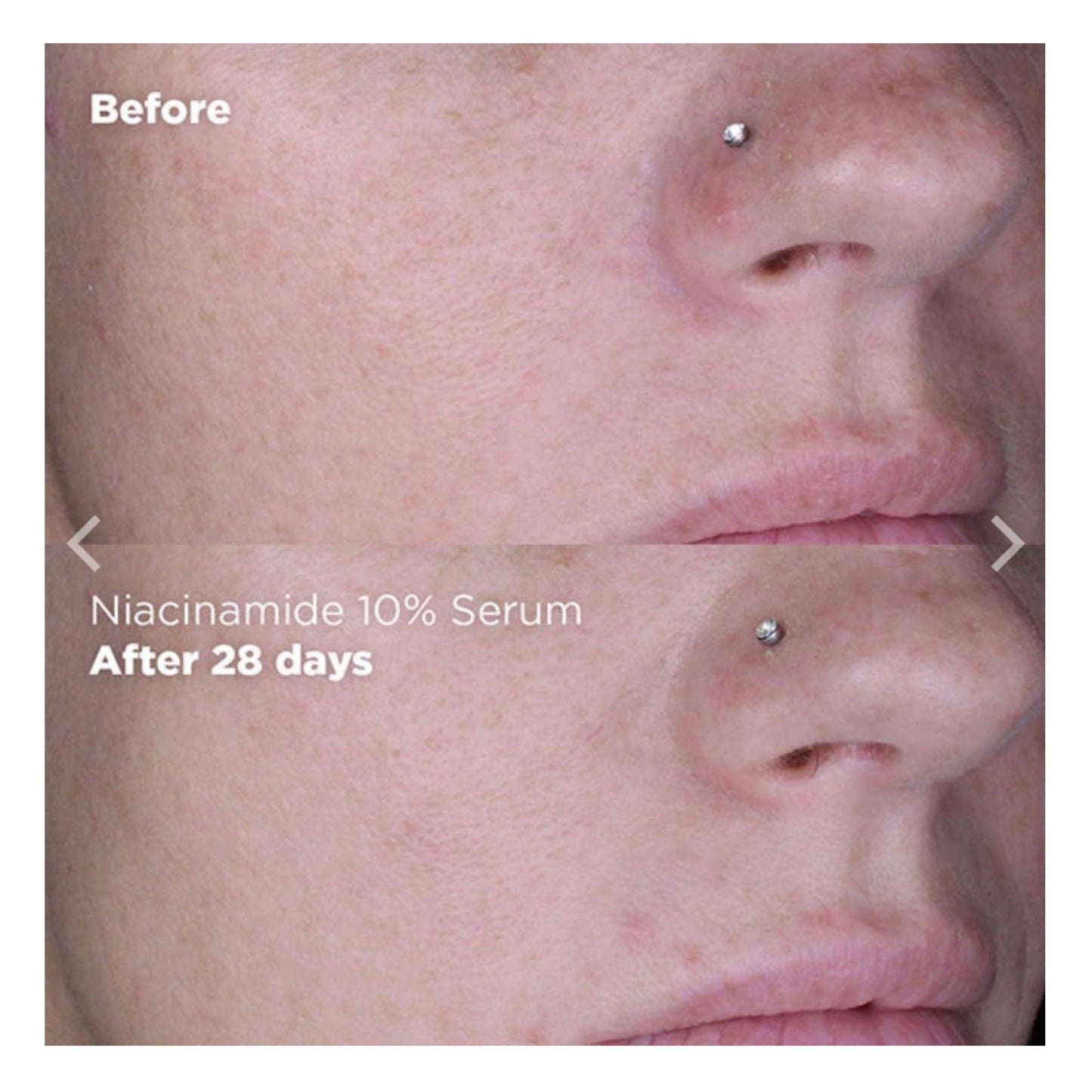 Skin Republic Niacinamide + Zinc Clears Skin & Brightens